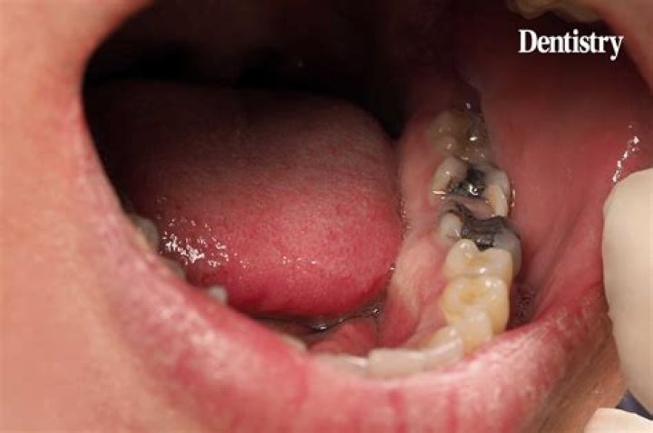 Are dentists exempt from the FFCRA?