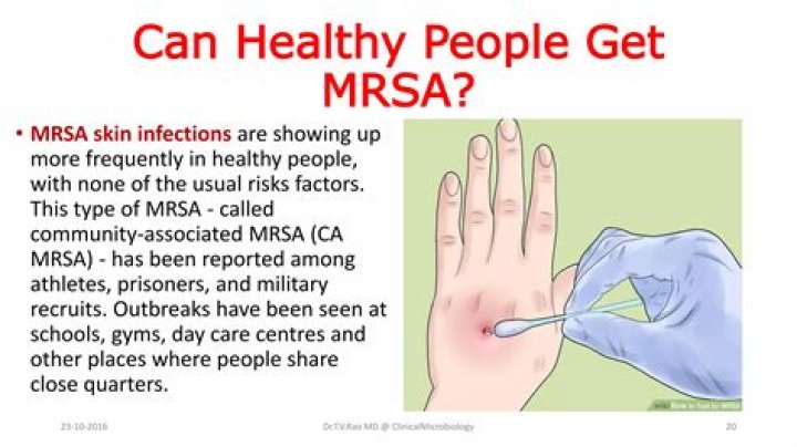 Can a healthy person die from MRSA?